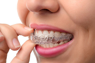 Comfort Care Dental | Scaling   Root Planing  Deep Cleaning , Wisdom Teeth and Extractions
