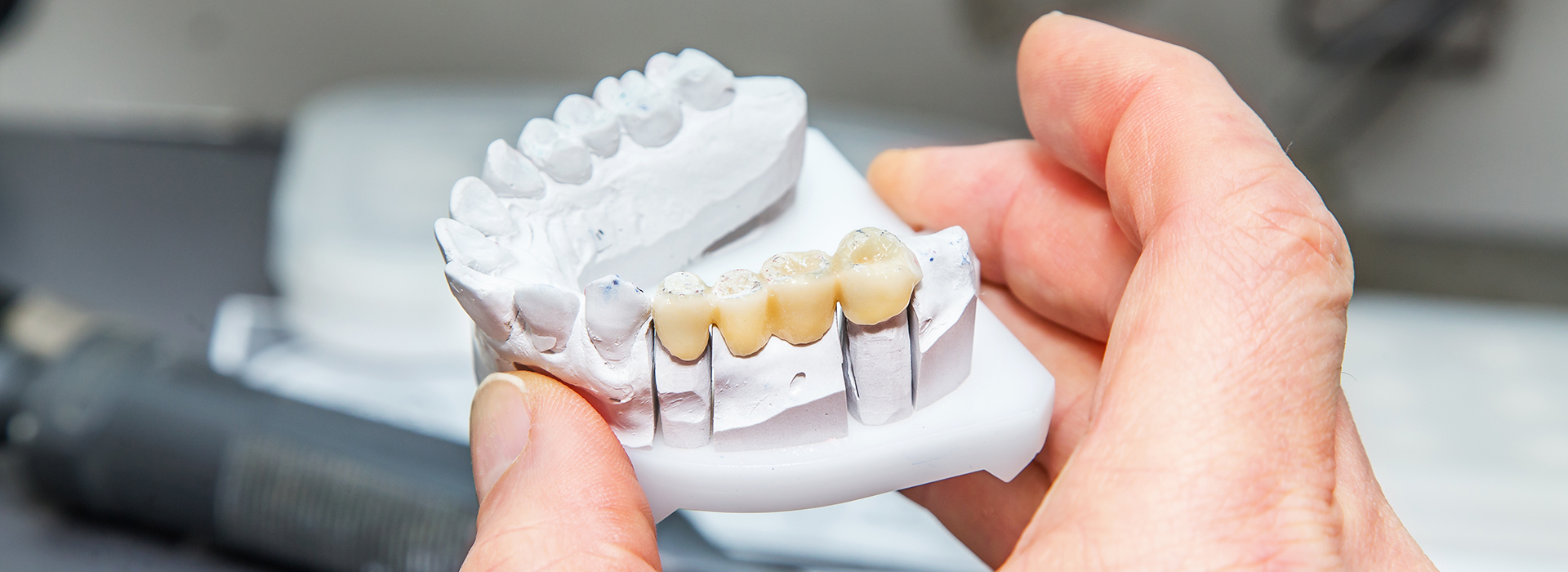 Comfort Care Dental | Sinus Lift, Implant Dentistry and Preventative Program