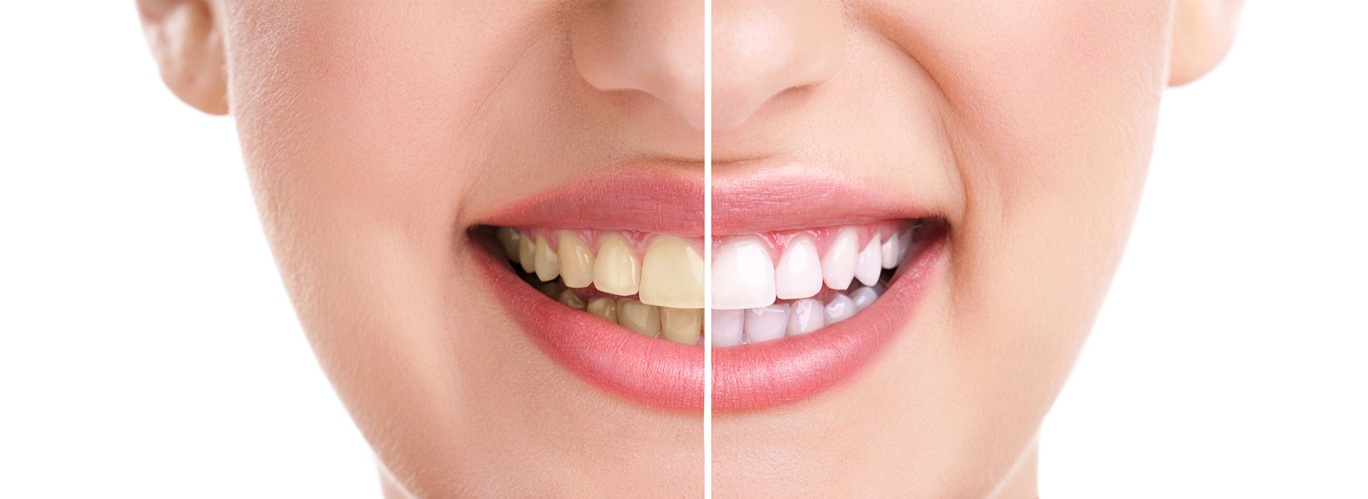 Comfort Care Dental | CBCT, Sedation Dentistry and Implant Dentistry